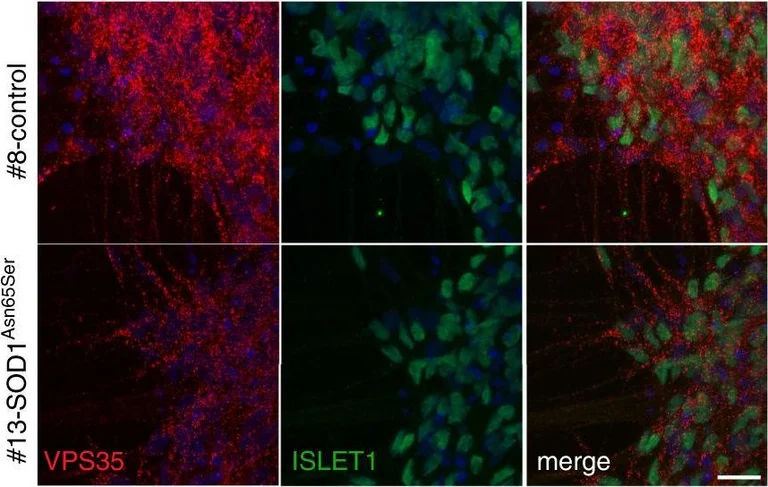 Immunohistochemistry - Anti-Islet 1 antibody - Neural Stem Cell Marker (AB20670)