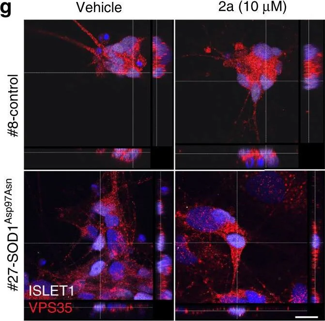 Immunohistochemistry - Anti-Islet 1 antibody - Neural Stem Cell Marker (AB20670)