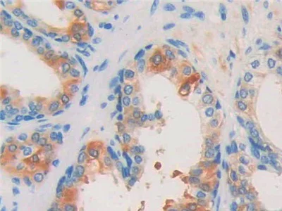 Immunohistochemistry (Formalin/PFA-fixed paraffin-embedded sections) - Anti-ISLR antibody (AB232986)