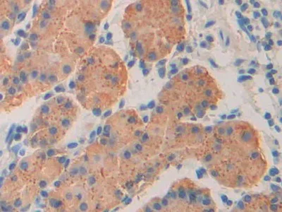 Immunohistochemistry (Formalin/PFA-fixed paraffin-embedded sections) - Anti-ISLR antibody (AB232986)
