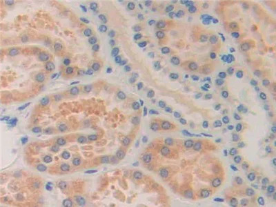 Immunohistochemistry (Formalin/PFA-fixed paraffin-embedded sections) - Anti-ISLR antibody (AB232986)