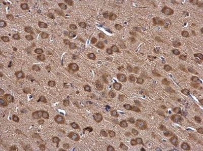 Immunohistochemistry (Formalin/PFA-fixed paraffin-embedded sections) - Anti-Isoleucyl tRNA synthetase antibody (AB229643)