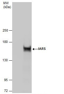Immunoprecipitation - Anti-Isoleucyl tRNA synthetase antibody (AB229643)