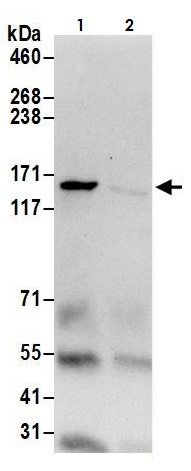 Immunoprecipitation - Anti-Isoleucyl tRNA synthetase antibody (AB264356)