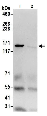 Immunoprecipitation - Anti-Isoleucyl tRNA synthetase antibody (AB264356)