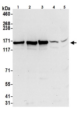 Western blot - Anti-Isoleucyl tRNA synthetase antibody (AB264356)