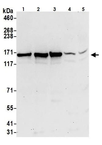 Western blot - Anti-Isoleucyl tRNA synthetase antibody (AB264356)
