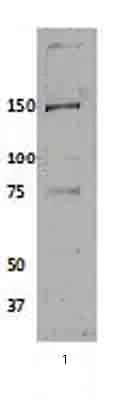 Western blot - Anti-Isoleucyl tRNA synthetase antibody (AB31533)