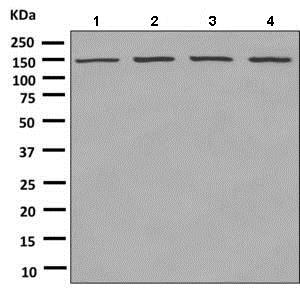 Western blot - Anti-Isoleucyl tRNA synthetase antibody [EPR10266(B)] (AB151557), expandable thumbnail