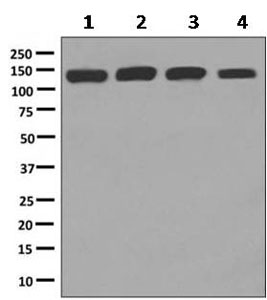 Western blot - Anti-Isoleucyl tRNA synthetase antibody [EPR10267] - BSA and Azide free (AB249075)