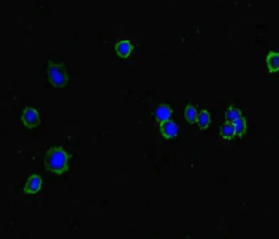 Immunocytochemistry/ Immunofluorescence - Anti-ISPD antibody (AB222793)
