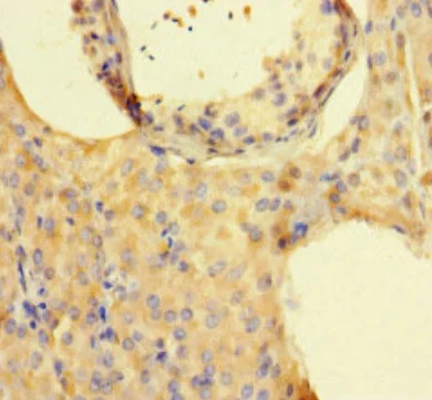 Immunohistochemistry (Formalin/PFA-fixed paraffin-embedded sections) - Anti-ISPD antibody (AB222793)