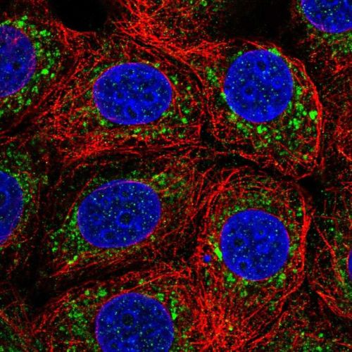 Immunocytochemistry - Anti-IST1 antibody (AB244502), expandable thumbnail