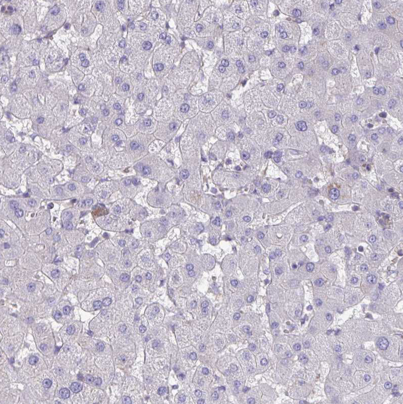 Immunohistochemistry (Formalin/PFA-fixed paraffin-embedded sections) - Anti-IST1 antibody (ab244502), expandable thumbnail