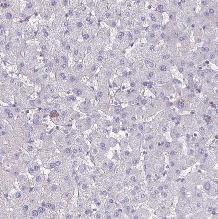 Immunohistochemistry (Formalin/PFA-fixed paraffin-embedded sections) - Anti-IST1 antibody (AB244502)