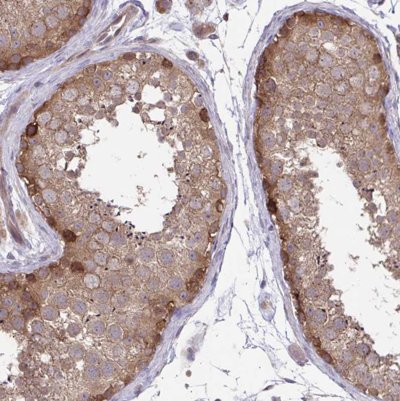 Immunohistochemistry (Formalin/PFA-fixed paraffin-embedded sections) - Anti-IST1 antibody (AB244502), expandable thumbnail