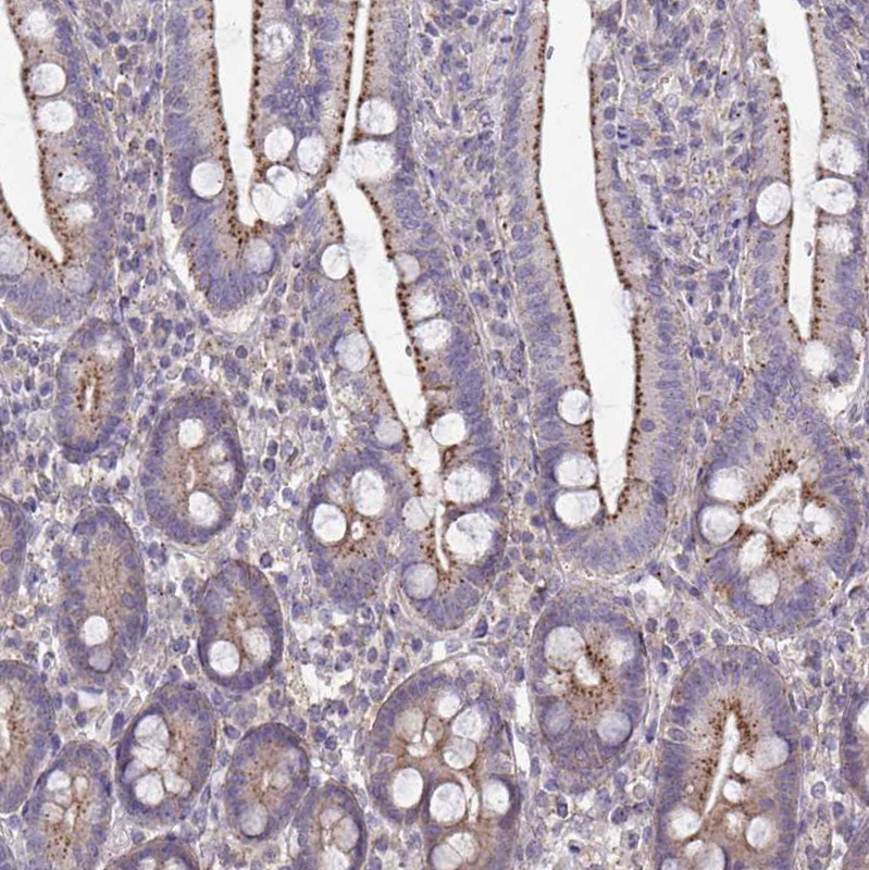 Immunohistochemistry (Formalin/PFA-fixed paraffin-embedded sections) - Anti-IST1 antibody (AB244502), expandable thumbnail