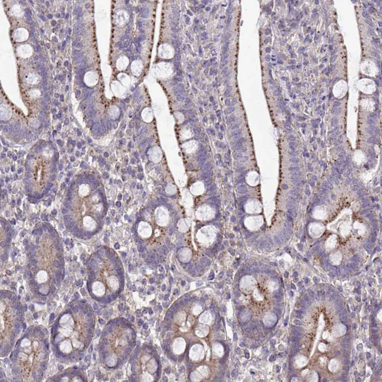 Immunohistochemistry (Formalin/PFA-fixed paraffin-embedded sections) - Anti-IST1 antibody (AB244502)