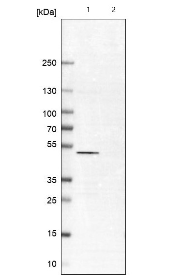 Western blot - Anti-IST1 antibody (AB244502), expandable thumbnail