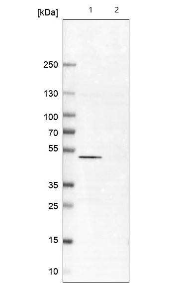 Western blot - Anti-IST1 antibody (AB244502)