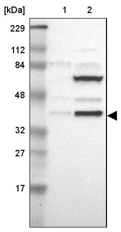 Western blot - Anti-ISY1 antibody (AB121250)