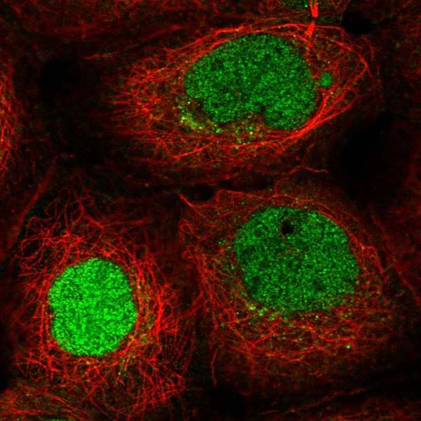 Immunocytochemistry/ Immunofluorescence - Anti-ITCH/AIP4 antibody (AB220637)