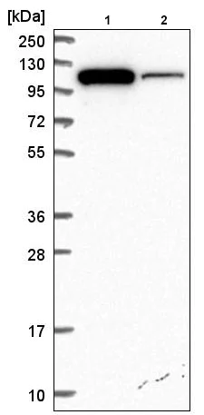 Western blot - Anti-ITCH/AIP4 antibody (AB220637)