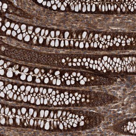 Immunohistochemistry (Formalin/PFA-fixed paraffin-embedded sections) - Anti-ITFG2 antibody (AB243732)
