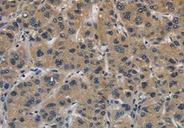 Immunohistochemistry (Formalin/PFA-fixed paraffin-embedded sections) - Anti-ITGA11 antibody (AB198826)