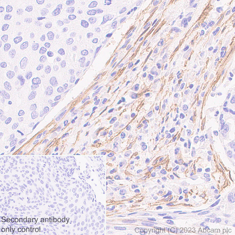 Immunohistochemistry (Formalin/PFA-fixed paraffin-embedded sections) - Anti-ITGA11 antibody [EPR28689-21] (AB316249)