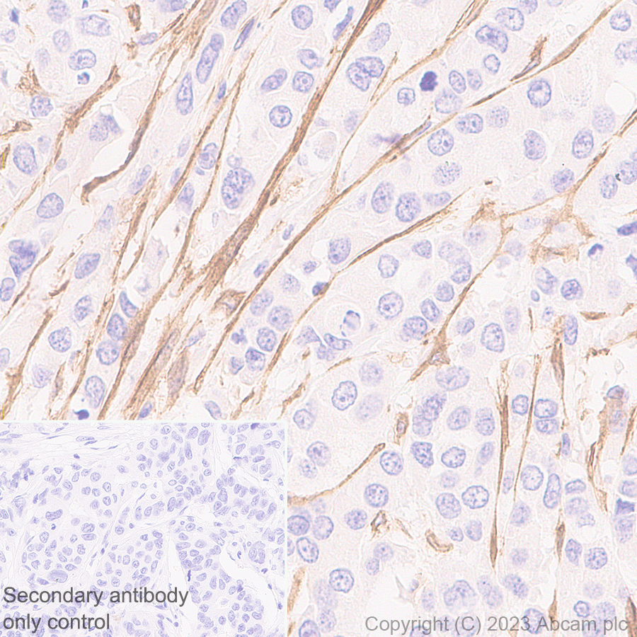 Immunohistochemistry (Formalin/PFA-fixed paraffin-embedded sections) - Anti-ITGA11 antibody [EPR28689-21] (AB316249)