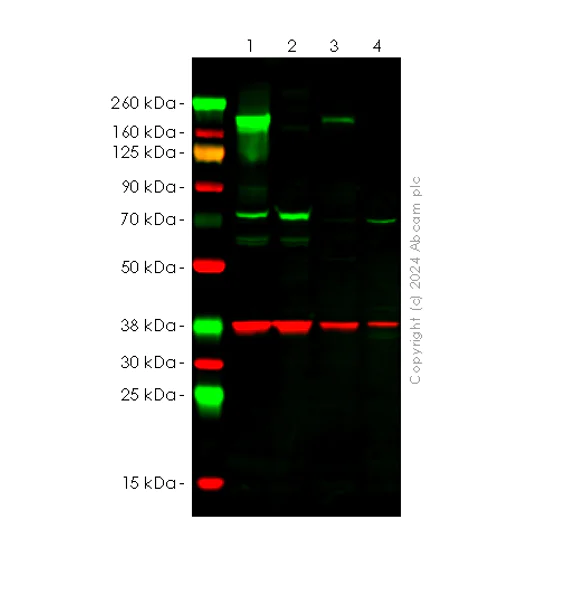 Western blot - Anti-ITGA11 antibody [EPR28689-21] (AB316249)