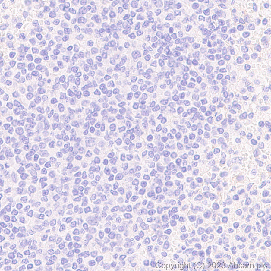 Immunohistochemistry (Formalin/PFA-fixed paraffin-embedded sections) - Anti-ITGA11 antibody [EPR28689-21] - BSA and Azide free (AB316250)