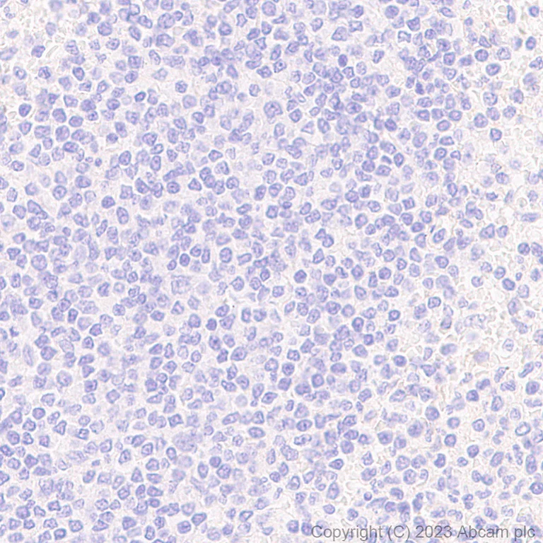 Immunohistochemistry (Formalin/PFA-fixed paraffin-embedded sections) - Anti-ITGA11 antibody [EPR28689-21] - BSA and Azide free (AB316250)