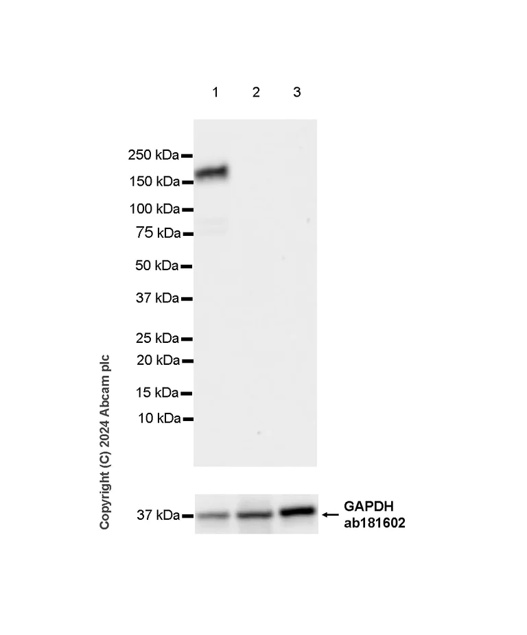 Western blot - Anti-ITGA11 antibody [EPR28689-21] - BSA and Azide free (AB316250)