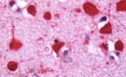 Immunohistochemistry (Formalin/PFA-fixed paraffin-embedded sections) - Anti-ITGA7 antibody [3C12] (AB195959)