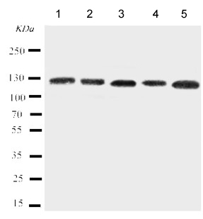 Western blot - Anti-ITGA7 antibody (AB182941)