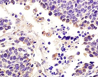 Immunohistochemistry (Formalin/PFA-fixed paraffin-embedded sections) - Anti-ITGA7 antibody (AB203254)