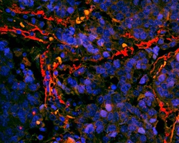 Immunohistochemistry (Formalin/PFA-fixed paraffin-embedded sections) - Anti-ITGA7 antibody (AB203254)