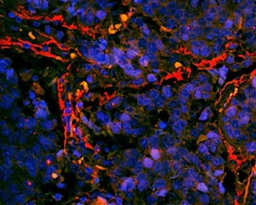 Immunohistochemistry (Formalin/PFA-fixed paraffin-embedded sections) - Anti-ITGA7 antibody (AB203254)