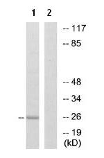 Western blot - Anti-ITGA7 antibody (AB75224)
