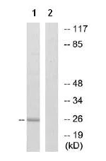 Western blot - Anti-ITGA7 antibody (AB75224)