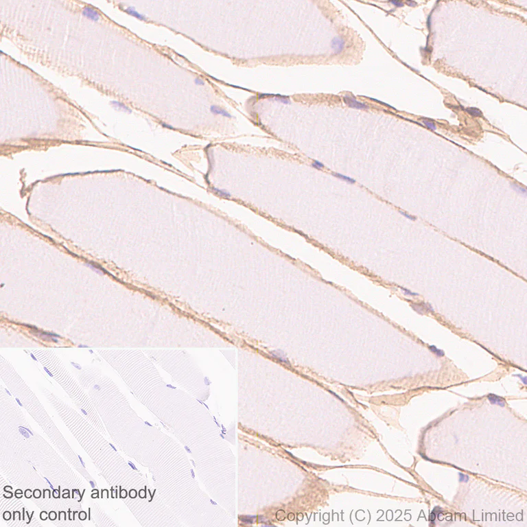Immunohistochemistry (Formalin/PFA-fixed paraffin-embedded sections) - Anti-ITGA7 antibody [EPR28509-556] (AB325935)