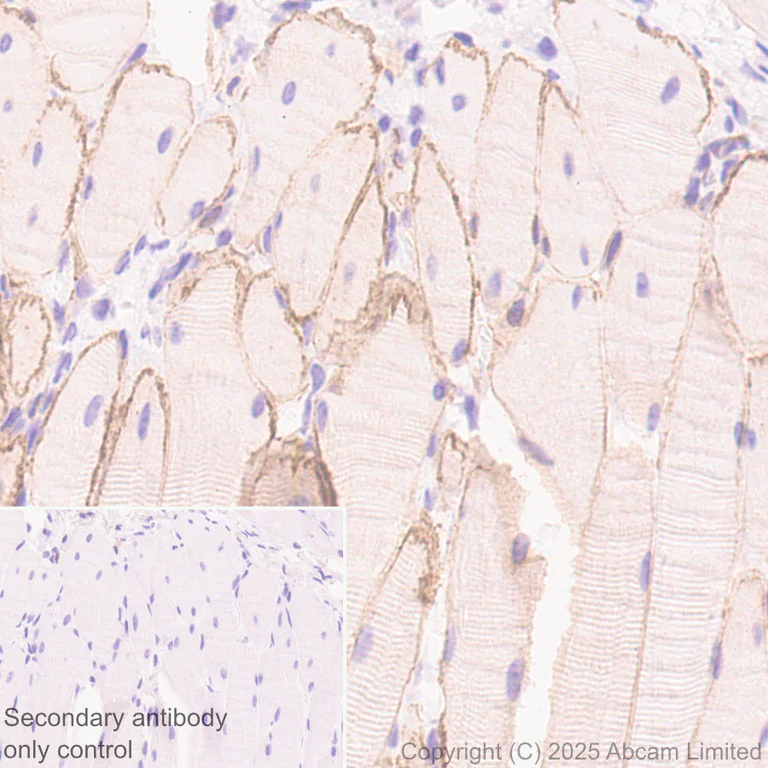 Immunohistochemistry (Formalin/PFA-fixed paraffin-embedded sections) - Anti-ITGA7 antibody [EPR28509-556] (AB325935)