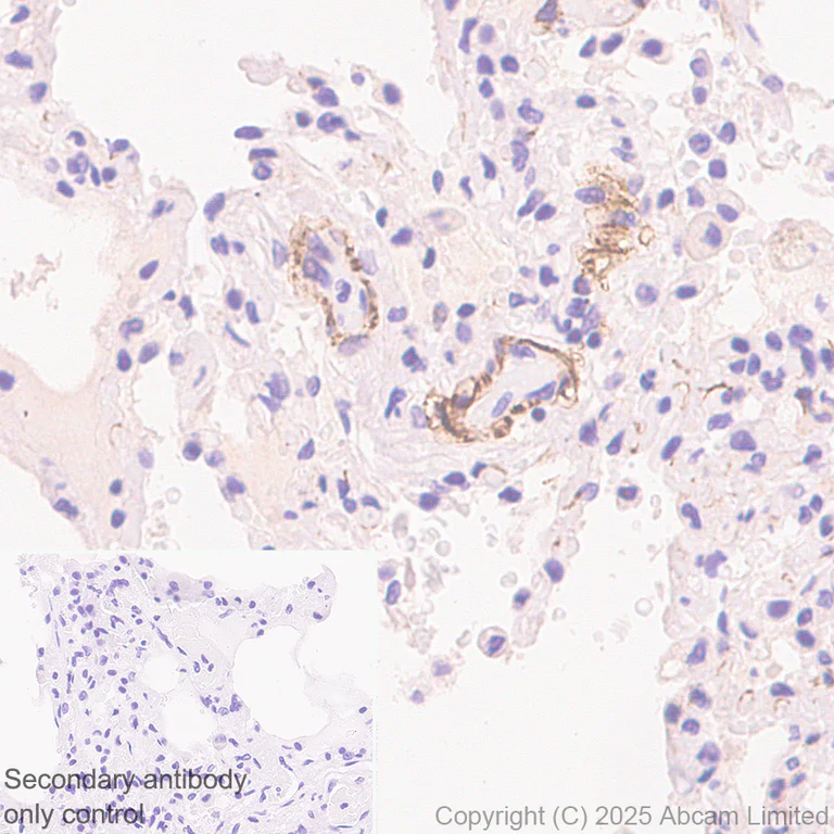 Immunohistochemistry (Formalin/PFA-fixed paraffin-embedded sections) - Anti-ITGA7 antibody [EPR28509-556] (AB325935)