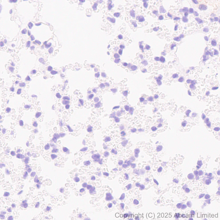 Immunohistochemistry (Formalin/PFA-fixed paraffin-embedded sections) - Anti-ITGA7 antibody [EPR28509-556] (AB325935)