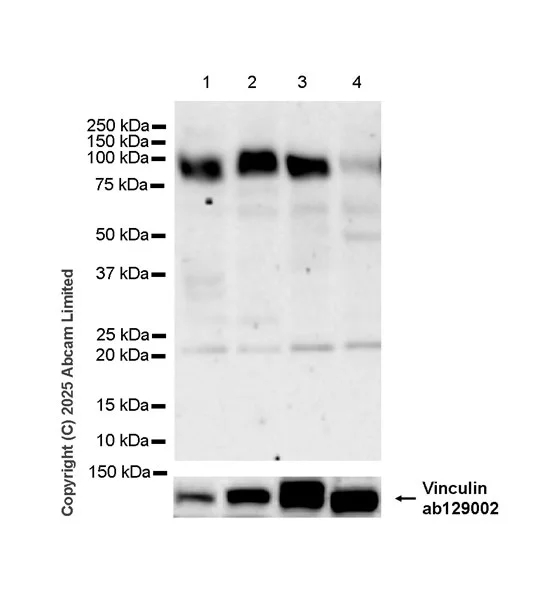 Western blot - Anti-ITGA7 antibody [EPR28509-556] (AB325935)