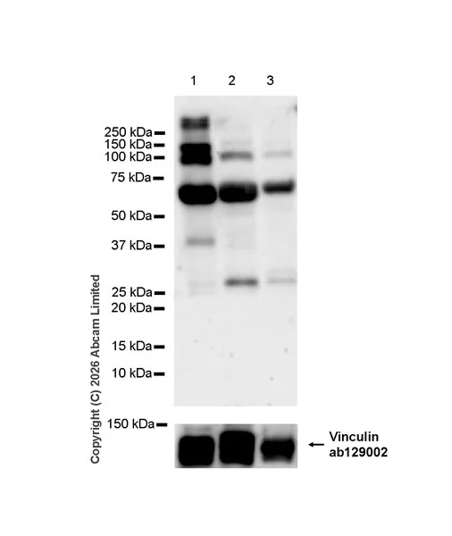 Western blot - Anti-ITGA7 antibody [EPR28509-556] (AB325935)