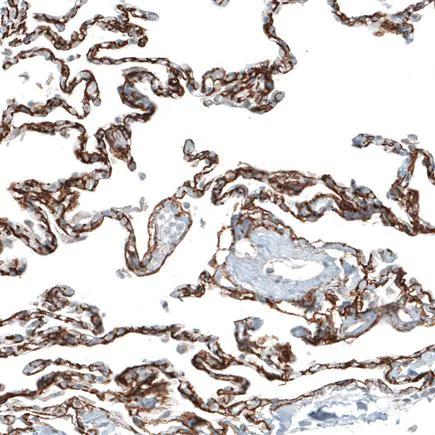 Immunohistochemistry (Formalin/PFA-fixed paraffin-embedded sections) - Anti-ITGA8 antibody [CL7304] (AB243027)