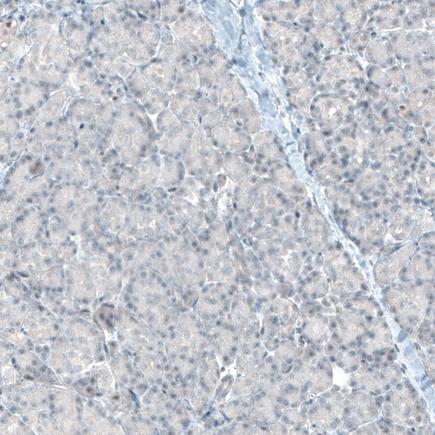 Immunohistochemistry (Formalin/PFA-fixed paraffin-embedded sections) - Anti-ITGA8 antibody [CL7304] (AB243027)